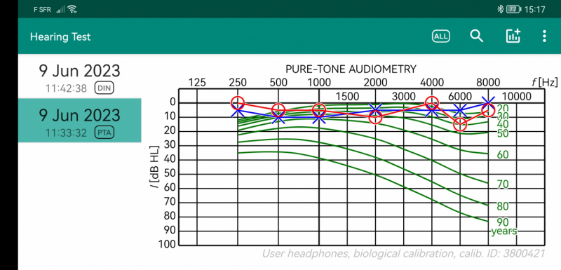 Age audio_par freq